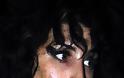 ΣΟΚΑΡΙΣΤΙΚΕΣ ΕΙΚΟΝΕΣ: H Amy Winehouse υπέφερε από βακτηριακή μόλυνση - Φωτογραφία 4