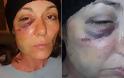 Βίντεο σοκ: Αστυνομικός κακοποιεί γυναίκα στο κρατητήριο και την αφήνει αιμόφυρτη - Φωτογραφία 2
