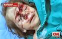 Συγκλονιστικές εικόνες με νεκρά παιδιά στη Συρία παρουσίασε το CNN [photos+videos] - Φωτογραφία 2