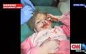 Συγκλονιστικές εικόνες με νεκρά παιδιά στη Συρία παρουσίασε το CNN [photos+videos] - Φωτογραφία 4