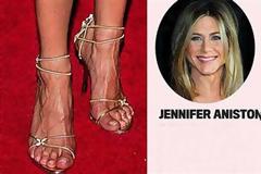 ΔΕΙΤΕ: Celebrities με απαίσια πόδια
