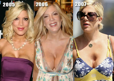 H Tori Spelling έκανε βίντεο πορνό για να ξεπληρώσει χρέη - Φωτογραφία 5