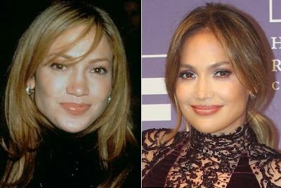 Η Jennifer Lopez απαντά αν έχει κάνει πλαστική επέμβαση! - Φωτογραφία 2