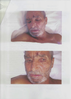 ΕΛ.ΑΣ: Αναζητεί την ταυτότητά του [Photos] - Φωτογραφία 2