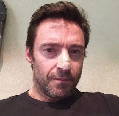 Έκκληση από τον Hugh Jackman για τον καρκίνο του δέρματος - Φωτογραφία 2