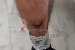 Στο νοσοκομείο από επίθεση σκύλων στην Πρέβεζα στο Μονολίθι