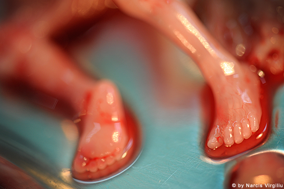 Συγκλονιστικές εικόνες ρουμάνου φωτογράφου από εκτρώσεις - προσοχή σκληρές εικόνες - Φωτογραφία 6