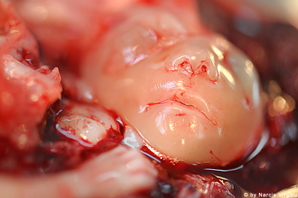 Συγκλονιστικές εικόνες ρουμάνου φωτογράφου από εκτρώσεις - προσοχή σκληρές εικόνες - Φωτογραφία 9