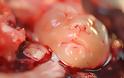 Συγκλονιστικές εικόνες ρουμάνου φωτογράφου από εκτρώσεις - προσοχή σκληρές εικόνες - Φωτογραφία 9