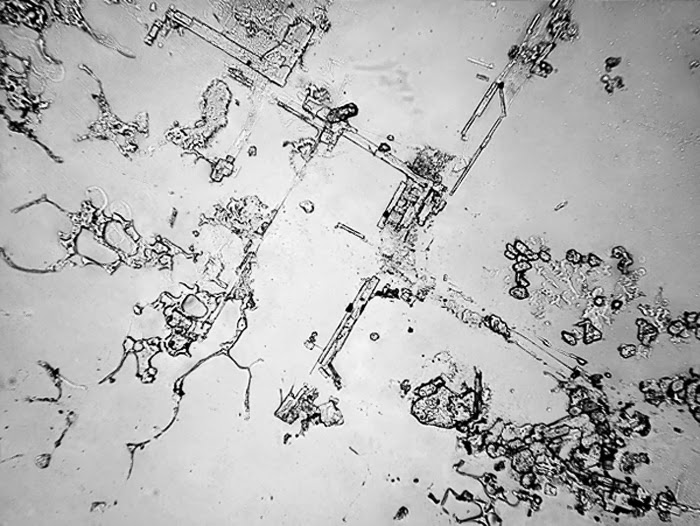 Τα δάκρυα στο μικροσκόπιο: Δεν φαντάζεστε πώς είναι το υγρό που τρέχει από τα μάτια μας - Φωτογραφία 5