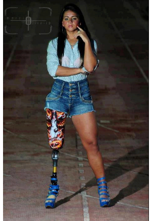 Η φωτογραφία της πανέμορφης κοπέλας με τεχνητό πόδι που συγκινεί και δίνει δύναμη - Φωτογραφία 2
