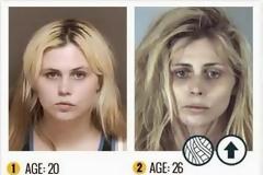 Σκληρές εικόνες - Το Krokodil τρώει κυριολεκτικά τις σάρκες των τοξικομανών