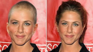 Άνιστον: Ξύρισε το κεφάλι της λόγω καρκίνου; - Φωτογραφία 1