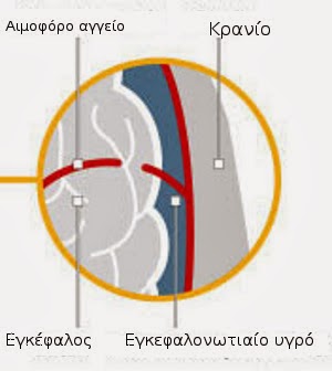 Τι συνέβη με τον Μίκαελ Σουμάχερ - Πως ο εγκέφαλος επηρεάστηκε από το χτύπημα - Φωτογραφία 3