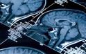 Τι συνέβη με τον Μίκαελ Σουμάχερ - Πως ο εγκέφαλος επηρεάστηκε από το χτύπημα