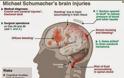Διάγραμμα με τις κρανιοεγκεφαλικές κακώσεις που έχει υποστεί ο Σουμάχερ [photo] - Φωτογραφία 2