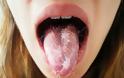 Τι κρύβει η άσχημη γεύση και η πικρίλα στο στόμα