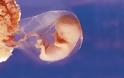 Αριζόνα: Οριστικά άκυρος ο νόμος που απαγορεύει τις εκτρώσεις