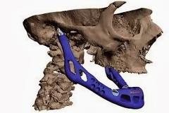 Τι είναι η 3D εκτύπωση και πως μπορεί να αναπαραγάγει κύτταρα και όργανα στην ιατρική; (video)