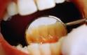 Μυστικά για αστραφτερή οδοντοστοιχία