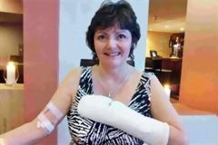 Παραλίγο να χάσει το χέρι της από τσίμπημα αράχνης!