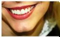 Όσα θέλετε να μάθετε για τη Λεύκανση των δοντιών - Φωτογραφία 2