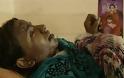 Πακιστάν-Της έκαψε το πρόσωπο με οξύ επειδή ήταν πολύ όμορφη