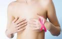 Καρκίνος μαστού: Δέκα διαφορετικές ασθένειες