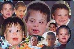 Mύθοι και αλήθειες για το Σύνδρομο DOWN