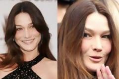 ΦΩΤΟ: «Η Μπρούνι μοιάζει με σκίουρο από το πολύ μπότοξ», λέει Αμερικάνος δερματολόγος