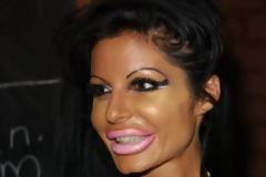 ΤΡΟΜΑΚΤΙΚΕΣ ΦΩΤΟΓΡΑΦΙΕΣ: Δείτε πως έγινε μετά από 30 πλαστικές επεμβάσεις!!!