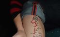 ΔΕΙΤΕ: Το πιο ασυνήθιστο τατουάζ στο πόδι - Φωτογραφία 15