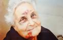 H φωτογραφία από το νησί της Κεφαλονιάς που ΣΥΓΚΛΟΝΙΖΕΙ - Η ηλικιωμένη που πληγώθηκε από το σεισμό και χαμογελά με ελπίδα