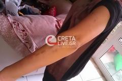 Πήγε για αποτρίχωση και βγήκε ... τσουρουφλισμένη!