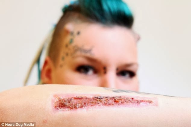 Φρίκη: Έγδαρε από το δέρμα της το τατουάζ με το όνομα του πρώην της και του το έστειλε ταχυδρομικώς [photos] - Φωτογραφία 2