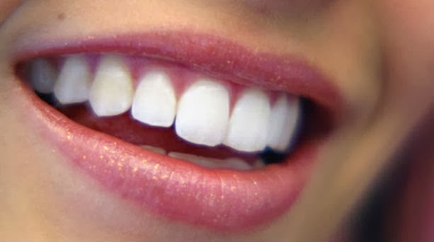 Λευκότερα δόντια σε έξι κινήσεις - Φωτογραφία 1