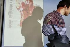 Κίνα: Γιατροί αφαίρεσαν καρκινικό όγκο 10 κιλών [photos]