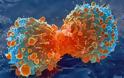 ΑΠΟΚΑΛΥΨΗ ΒΟΜΒΑ: Ο καρκίνος είναι ένας μύκητας και είναι ιάσιμος! - Φωτογραφία 1