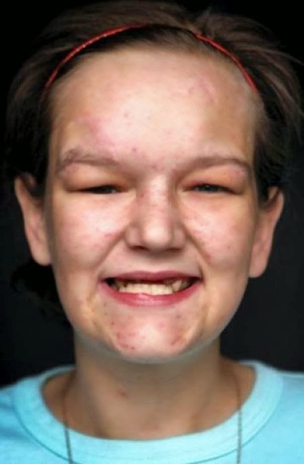 Σοκαριστική μεταμόρφωση 27χρονης από ναρκωτικά [photos] - Φωτογραφία 3