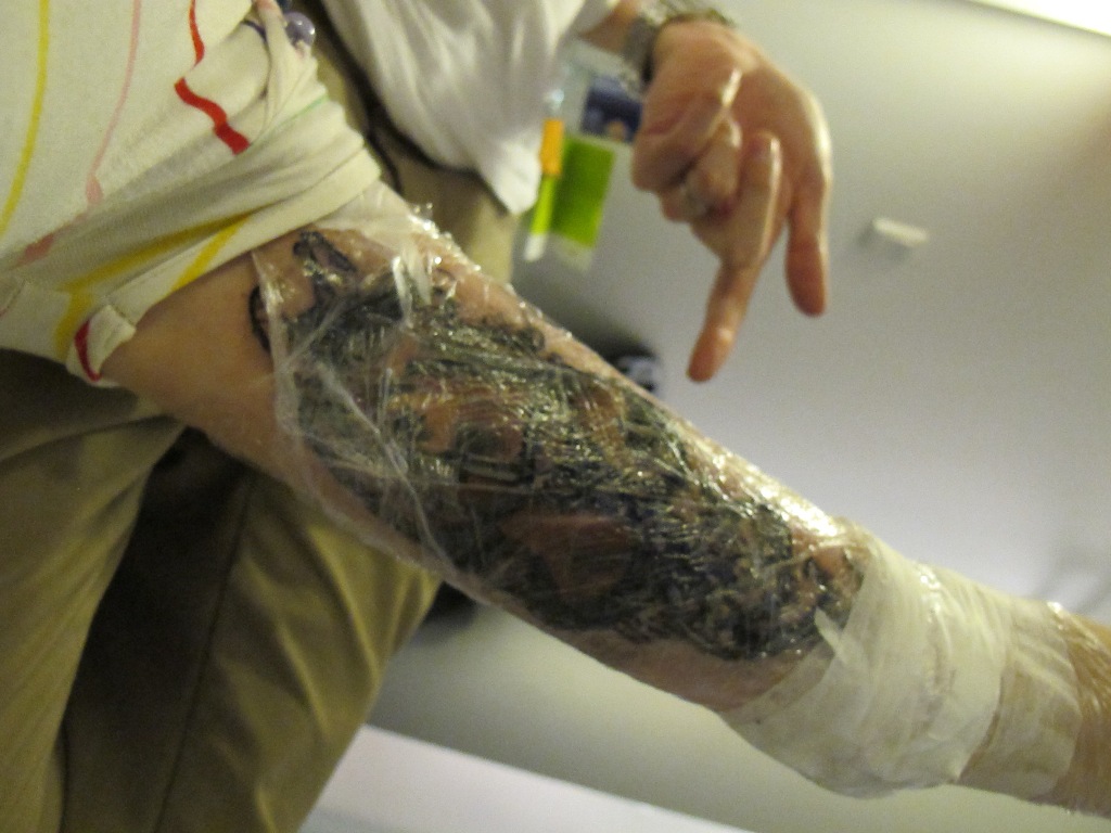 Η φροντίδα ενός νέου τατουάζ - Φωτογραφία 2