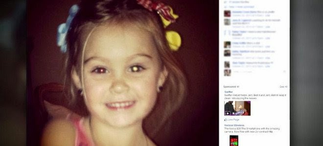 Το Facebook έσωσε τα μάτια ενός τρίχρονου κοριτσιού -Διάγνωση από φωτογραφία - Φωτογραφία 1