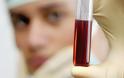Ένα νέο βελτιωμένο τεστ αίματος-DNA ανιχνεύει τον καρκίνο