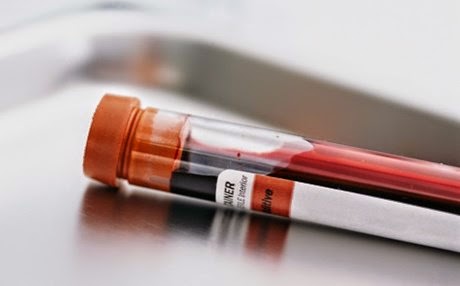 Πώς βοηθάει μια απλή εξέταση αίματος στην πρόληψη του καρκίνου - Φωτογραφία 1