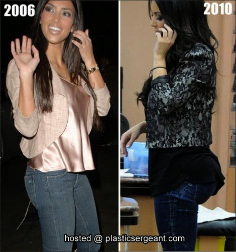 Η Κιμ Καρντάσιαν πριν και μετά τις πλαστικές επεμβάσεις στα οπίσθιά της - Φωτογραφία 6