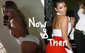 Η Κιμ Καρντάσιαν πριν και μετά τις πλαστικές επεμβάσεις στα οπίσθιά της - Φωτογραφία 3