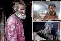 Η τραγική ιστορία του πιο βρώμικου ανθρώπου στην Ευρώπη - Αντέχετε να τον δείτε; [photos]
