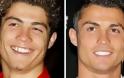 ΔΕΙΤΕ: Διάσημοι σταρ πριν και μετά τον οδοντίατρο