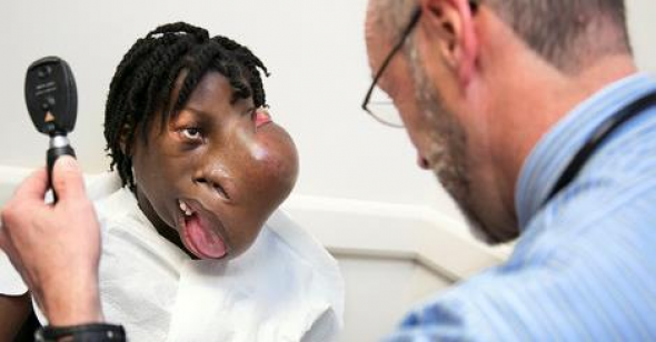 Σοκ: Κοριτσάκι 15 ετών με τεράστιο όγκο 2 κιλών στο πρόσωπο του - Ξεκίνησε σαν ένα μικρό μπιζέλι στη μύτη του [video] - Φωτογραφία 1
