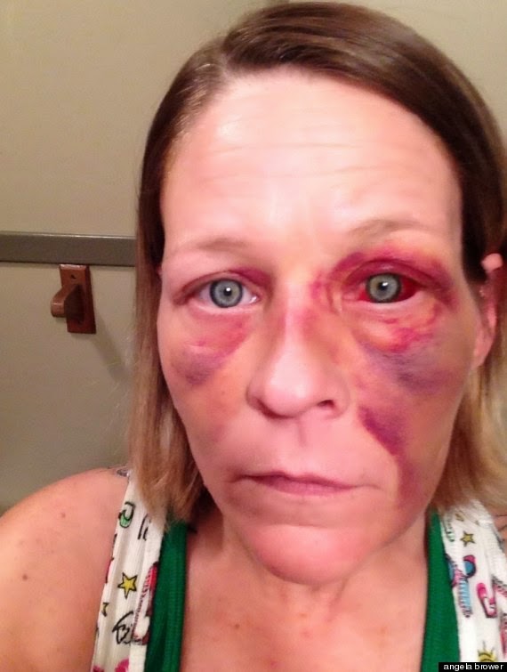 ΣΟΚ: Γυναίκα στις ΗΠΑ έπεσε θύμα άγριου ξυλοδαρμού από τον άνανδρο σύζυγο της, στη συνέχεια έβγαλε selfies και τις δημοσίευσε [photos] - Φωτογραφία 3