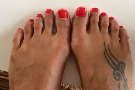Η «πλαστική της Σταχτοπούτας» γίνεται μόδα: Γυναίκες κόβουν τα δάχτυλα των ποδιών τους για να φορούν πέδιλα [photos]] - Φωτογραφία 4
